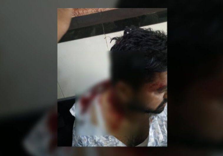 LIVE : मुंबईत मनसे कार्यकर्त्यांवर फेरीवाल्यांचा जीवघेणा हल्ला Hawkers Attack On Mns Workers With Rods And Sticks In Malad Live Update LIVE : मुंबईत मनसे कार्यकर्त्यांवर फेरीवाल्यांचा जीवघेणा हल्ला